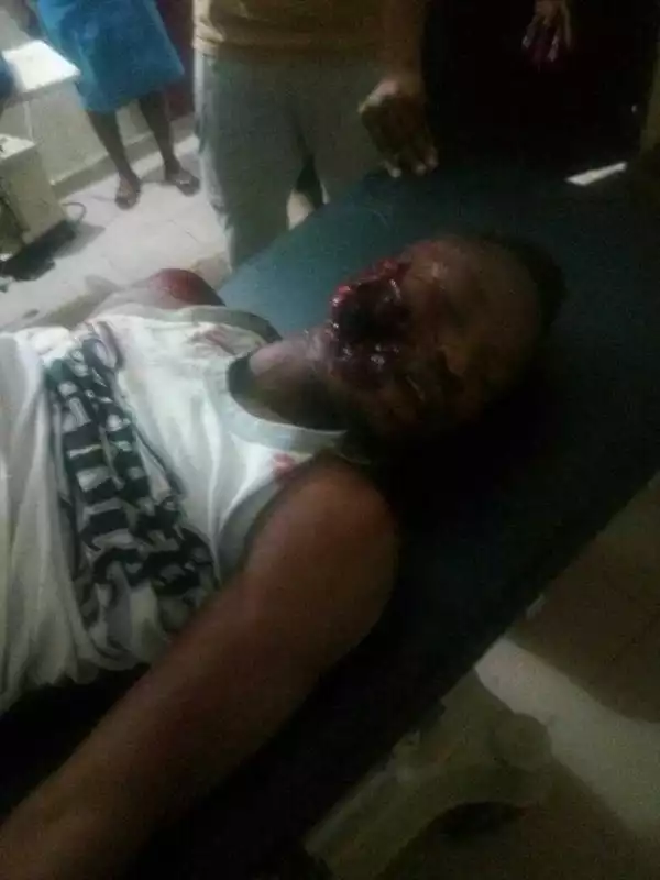 Just In: IMSU Student Shot Dead In Fresh Robbery Attack (Graphic Photo)